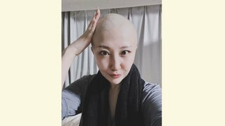 【がん闘病】西丸優子さん「とても不安なこと」「抗がん剤で白髪になってしまったのでしょうか」