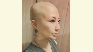 【がん闘病】　西丸優子さん　 "まつ毛の脱毛"　 「やはり抗がん剤には勝てないかー」　抗がん剤の前後で比較「ツケマデビューするしかない！」