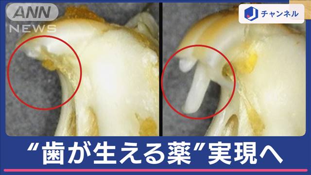 “歯が生える薬”ついに実現か？！マウスで成功！ヒトへの治験開始へ