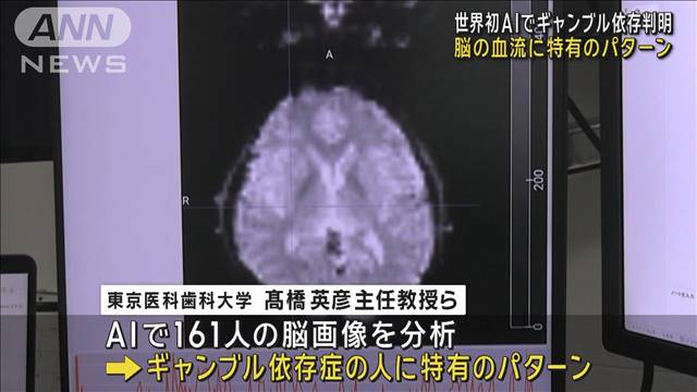 世界初　AIでギャンブル依存判明　脳の血流に特有のパターン