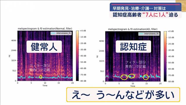 認知症高齢者“7人に1人”へ　早期発見・治療・介護…対策は