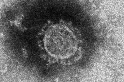 コロナ情報発信の国内専門家、半数が「攻撃受けた」　殺害予告も