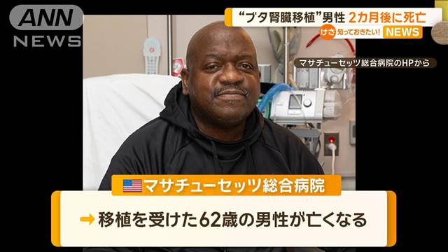 “ブタ腎臓移植”の男性　手術から2カ月後に死亡