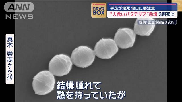 “人食いバクテリア”急増　3割死に　手足が壊死　傷口に注意