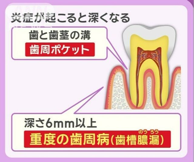 奥歯失うと認知症リスク増　奥歯を守るみがき方 3つのコツ