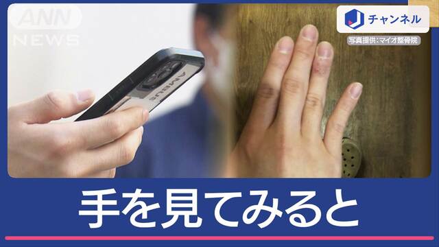 スマホ小指＆腱鞘炎に注意　セルフチェック方法も