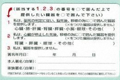 知的障害者の臓器提供、一律無効は「前理事長が異なる解釈」　第三者委