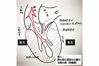 遺伝的要因も…心臓の筋肉が分厚くなる「肥大型心筋症」と「僧帽弁閉鎖不全症」～『ブラックペアン』監修ドクターが解説 vol.12～