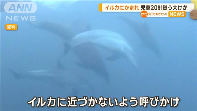 イルカにかまれ…児童が20針縫う大けが