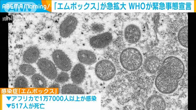 「エムポックス」急拡大でWHO緊急事態宣言　アフリカ中部などで今年1万千人以上が感染