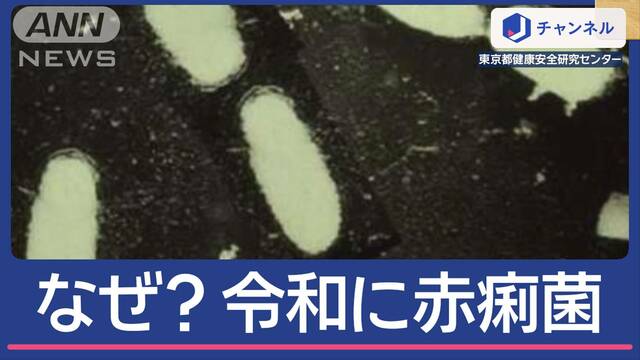 なぜ？令和に「赤痢菌」食中毒  強い感染力＆潜む“落とし穴”