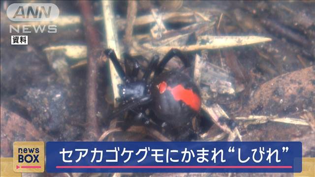 セアカゴケグモにかまれ“しびれ” 大阪・岸和田市