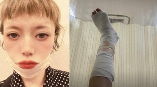 広田レオナさん　「足首骨折してるみたい」　痛々しい足の写真をアップ　アスファルトが崩れて「転んでしまった」