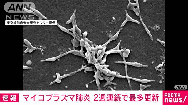 【速報】マイコプラズマ肺炎　全国の患者数「1.94人」　2週連続で過去最多を更新