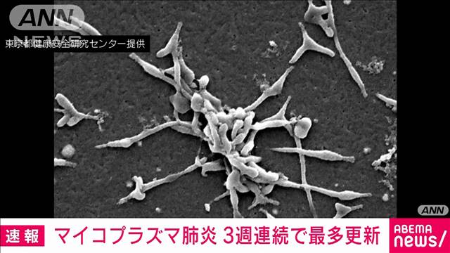 マイコプラズマ肺炎の全国患者数　3週連続で過去最多を更新