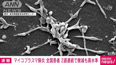 【速報】マイコプラズマ肺炎　全国患者数「2.43人」　2週連続でわずかに減少も高水準